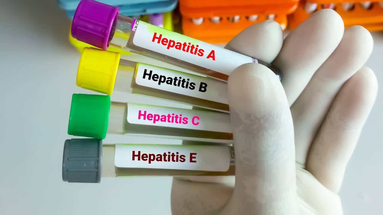 “Hepatitte aşılama, kronik enfeksiyonları önlemede yüzde 95 etkili”